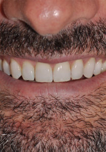 Caso ortodoncia Aguado