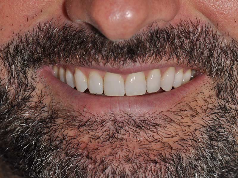 Caso ortodoncia Aguado